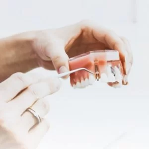 Implantes Dentales Sevilla