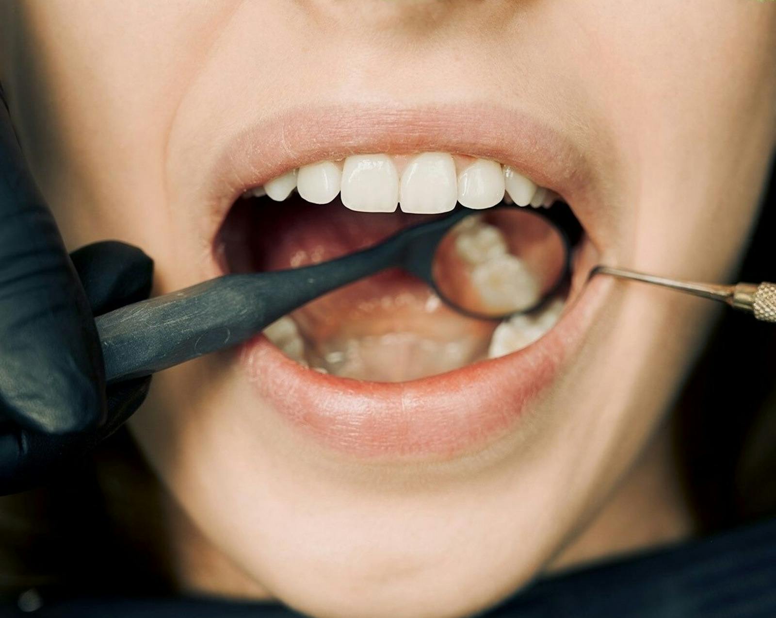 Ortodoncia e Invisalign en Sevilla - Piñero & Bilbao