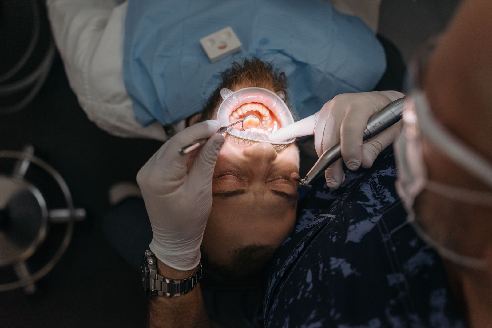 Cirugía bucal y periodoncia en Sevilla - Piñero & Bilbao