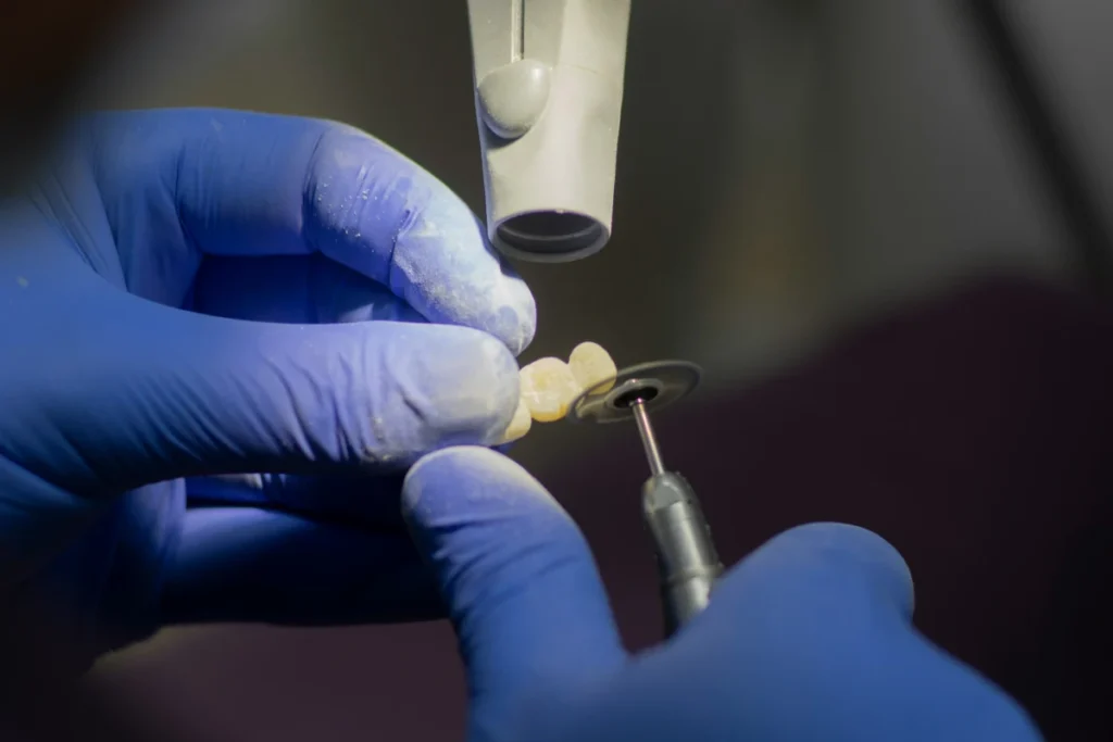 implante dental en sevilla