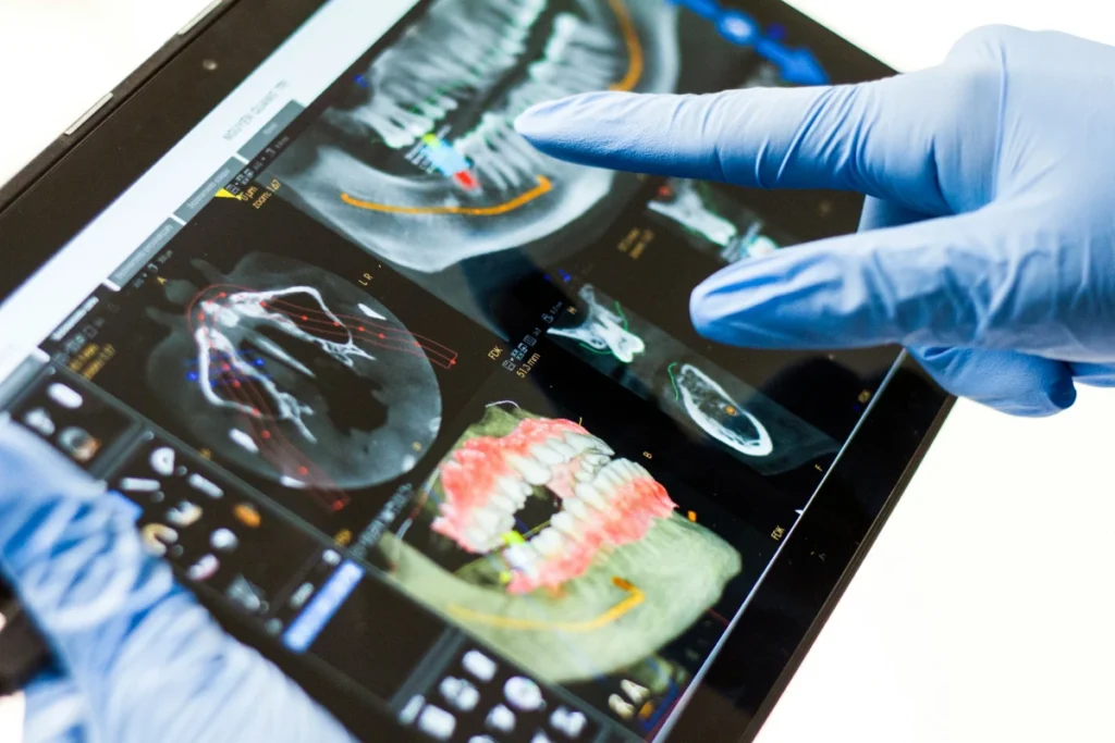 implantes dentales pinero y bilbao