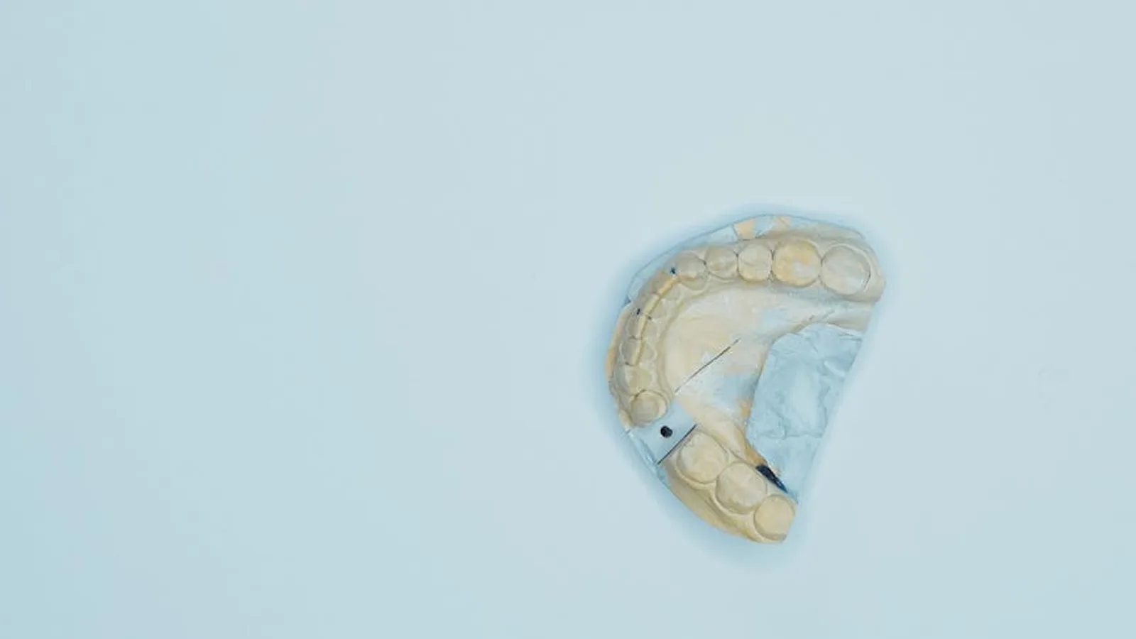ortodoncia en adultos en Señales de que necesitas ortodoncia aunque tu sonrisa parezca bien