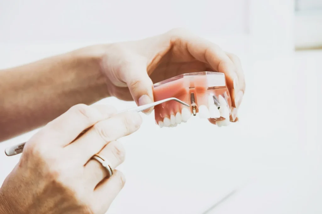 rehabilitacion dental en sevilla