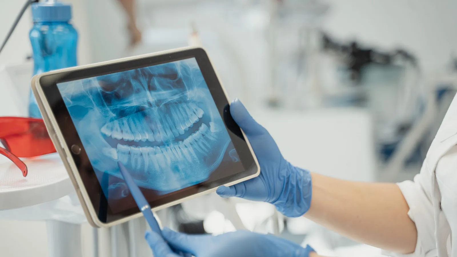 estudio de sonrisa en Diseño de sonrisa: en qué consiste el estudio y qué esperar